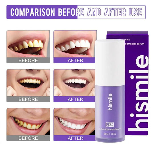 HiSmile V34™